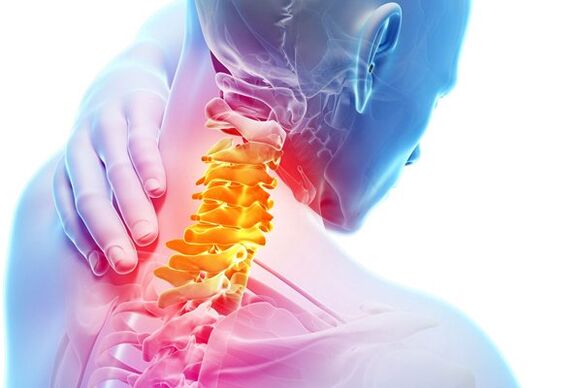 As causas da osteocondrose cervical