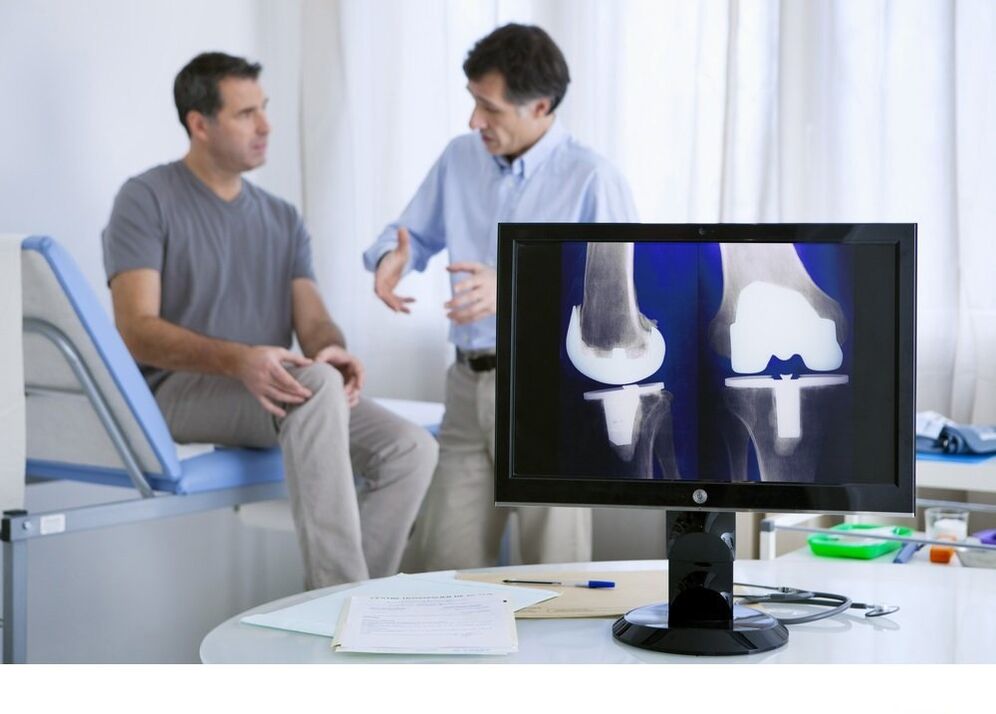 artrose da articulación do xeonllo na imaxe x -ray